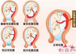 北京试管代孕价钱，北京正规代孕公司排名的必要性