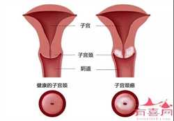 北京试管代孕案例，北京的代孕价格